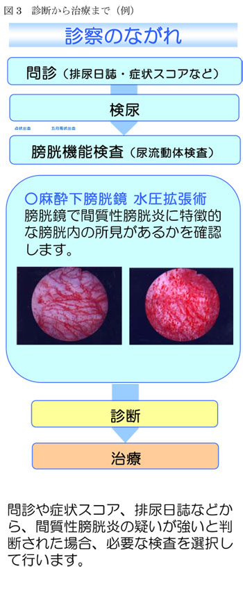 間質性膀胱炎 福岡県泌尿器科医会